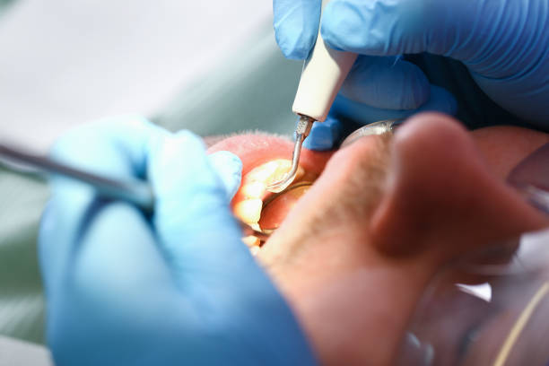 Best Walk-In Emergency Dentist in Montevideo, MN